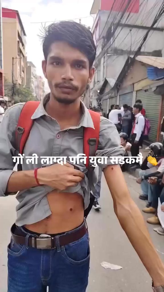 ५४ जना घाइतेहरु देशको विभिन्न अस्पतालमा उपचार गराउदै