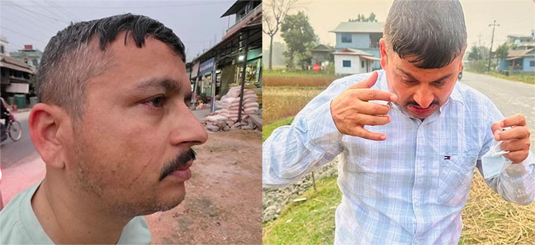 चुनावी रिपोर्टिङमै पत्रकारमाथि आक्रमण, प्रेस सेन्टरको कडा आपत्ति